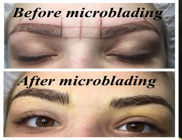 Microblading